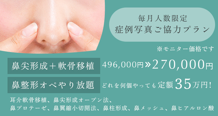 毎月人数限定 症例写真ご協力プラン 鼻尖形成+軟骨移植 496,000円→270,000円、鼻整形オペやり放題 どれを何個やっても35万円