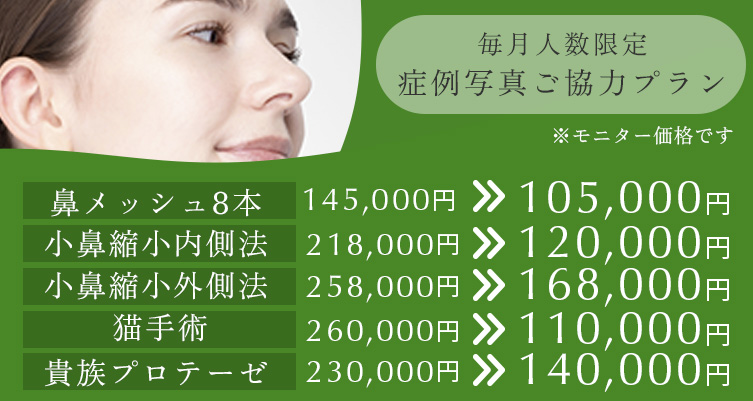 毎月人数限定 症例写真ご協力プラン 鼻メッシュ8本 145,000円→105,000円、小鼻縮小内側法 218,000円→120,000円、小鼻縮小外側法 378,000円→168,000円、猫手術 260,000円→110,000円、貴族プロテーゼ 230,000円→140,000円