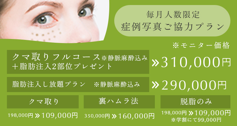 毎月人数限定 症例写真ご協力プラン クマ取りフルコース※静脈麻酔込み+脂肪注入2部位プレゼント 310,000円、脂肪注入し放題プラン※静脈麻酔込み 290,000円、クマ取り 198,000円→109,000円、裏ハラム法 350,000円→160,000円、脱脂のみ 198,000円→109,000円(学割にて99,000円)