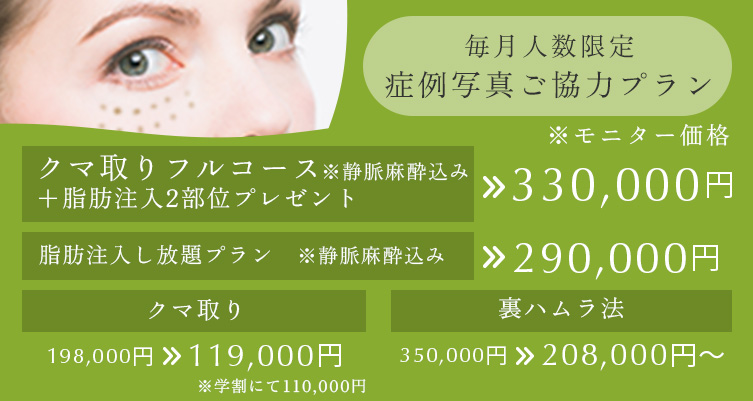 毎月人数限定 症例写真ご協力プラン クマ取りフルコース※静脈麻酔込み+脂肪注入2部位プレゼント 330,000円、脂肪注入し放題プラン※静脈麻酔込み 290,000円、クマ取り 198,000円→119,000円、裏ハムラ法 350,000円→208,000円