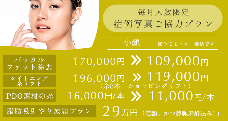 毎月人数限定 症例写真ご協力プラン 小顔 バッカルファット除去 170,000円→109,000円、タイトニング糸リフト 196,000円→119,000円(糸8本+ショッピングリフト)、PDO素材の糸 16,000円/本→11,000円/本、脂肪吸引やり放題プラン 29万円(定額、かつ静脈麻酔込み)