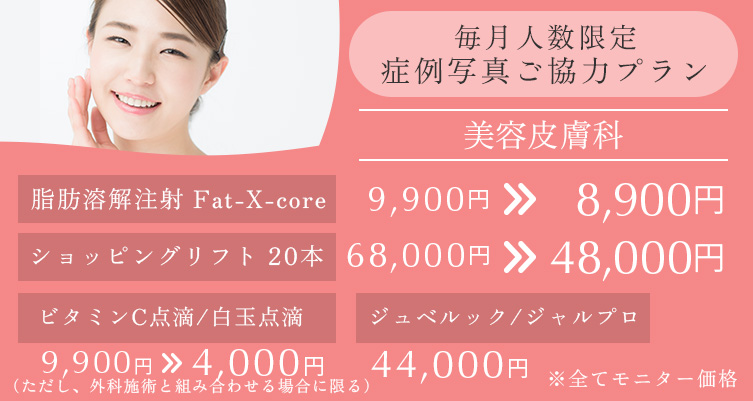 毎月人数限定 症例写真ご協力プラン 美容皮膚科 脂肪溶解注射 Fat-X-core 9,900円→8,900円、ショッピングリフト20本 68,000円→48,000円、ビタミンC点滴/白玉注射 9,900円→4,000円(ただし外科手術と組み合わせる場合に限る)、ジュベルック/ジャルプロ 44,000円